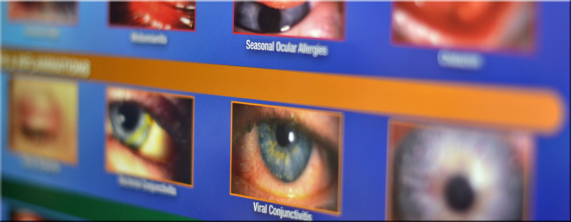 Eye and Vision Resource Center