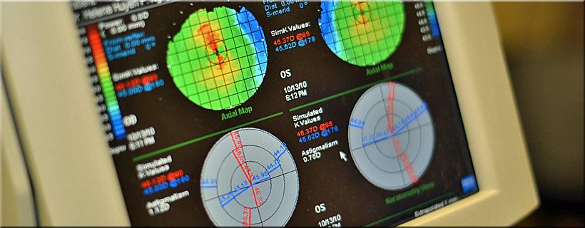 Advanced diagnostic technology used during eye exams at Optima Optometry